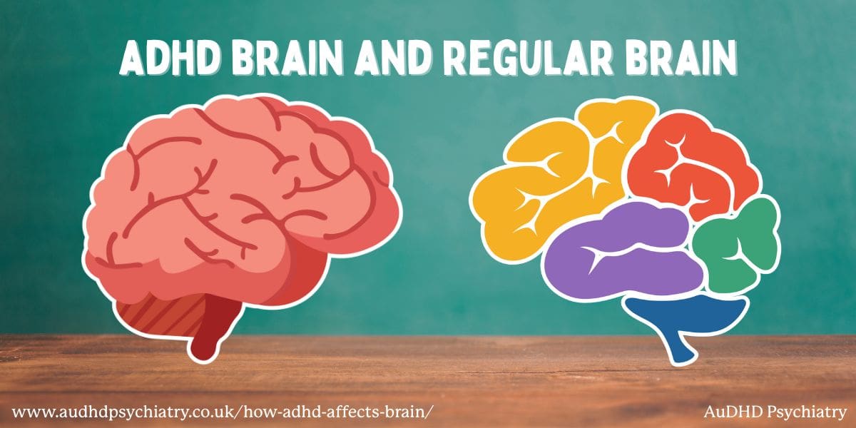 Graphic of ADHD Brain and Regular Brain